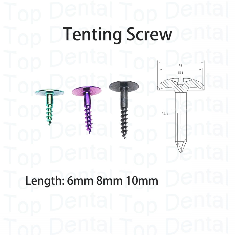 10pcs Dental GBR System Bone S – обзор и цена Stabilizer Screw In