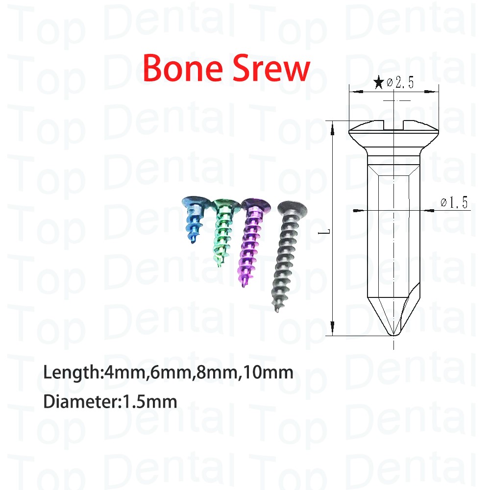 10pcs Dental GBR System Bone S – обзор и цена Stabilizer Screw In